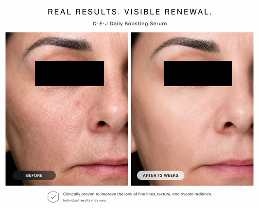 Clinical before and after results demonstrating visibly smoother skin, improved texture, and reduced appearance of fine lines after 12 weeks of Revision Skincare D·E·J Daily Boosting Serum
