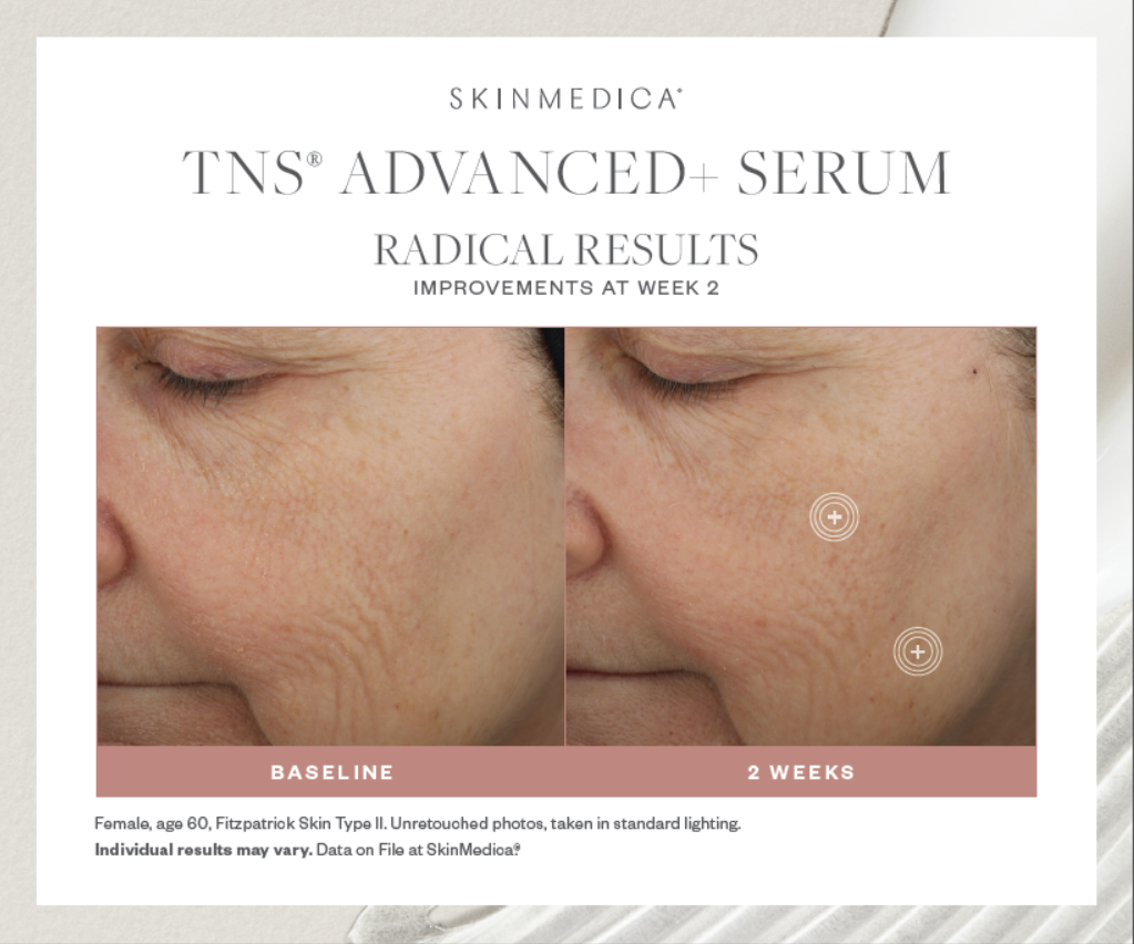 SkinMedica TNS® Advanced+ Serum