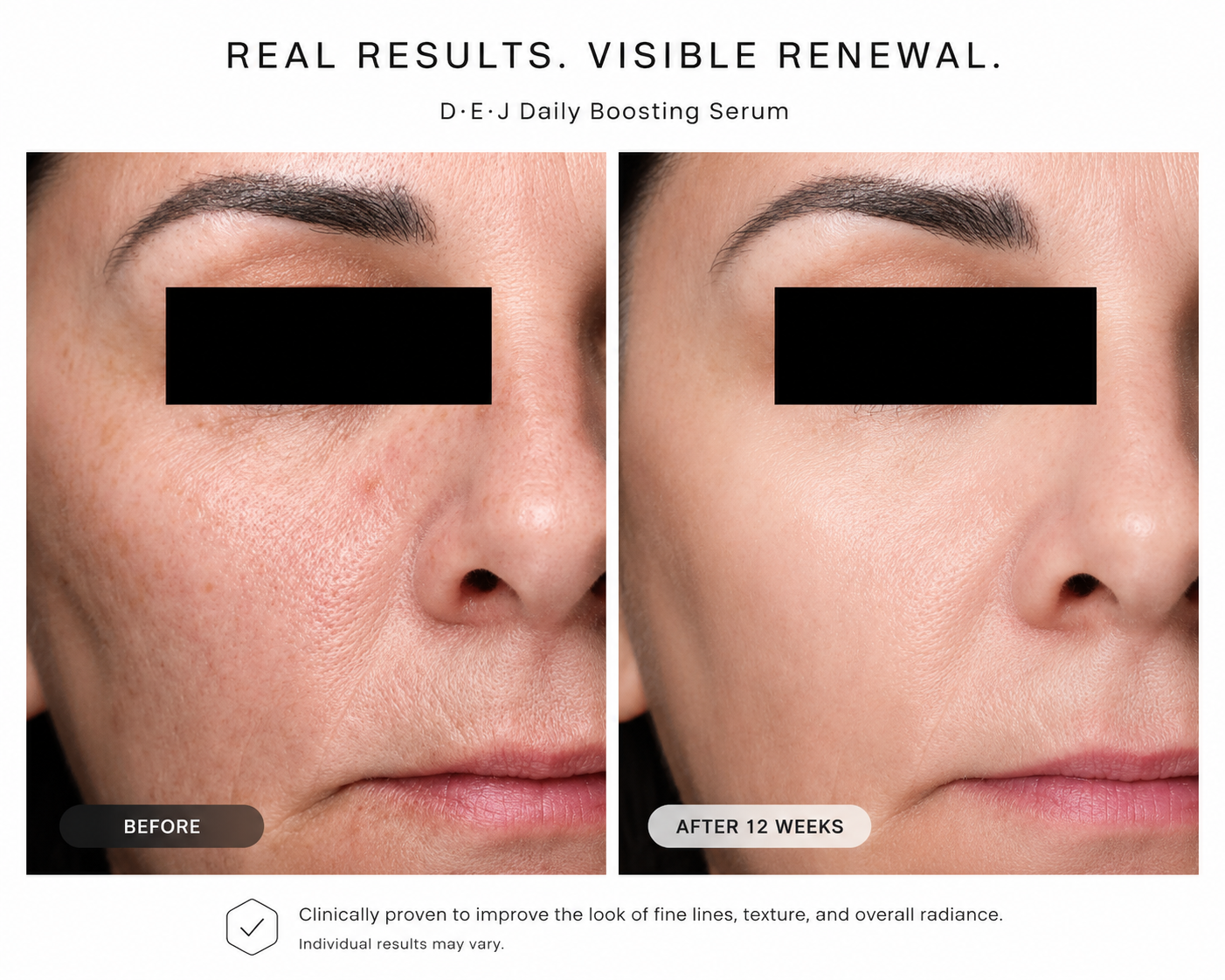 Clinical before and after results demonstrating visibly smoother skin, improved texture, and reduced appearance of fine lines after 12 weeks of Revision Skincare D·E·J Daily Boosting Serum