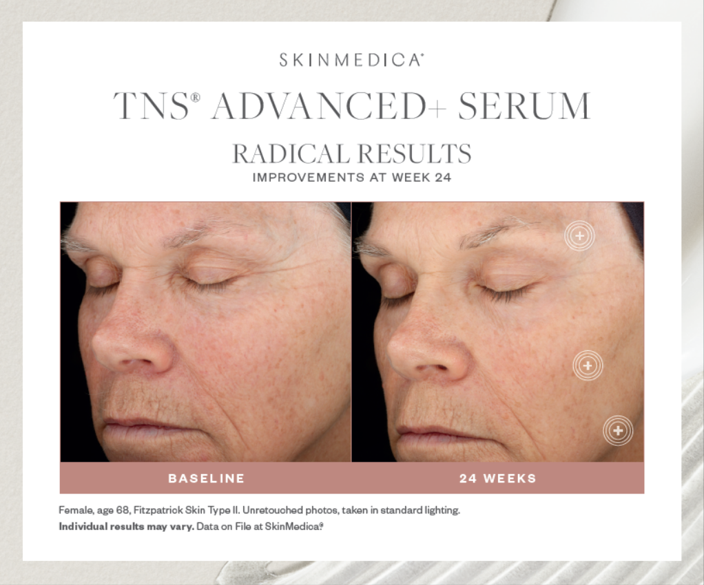 SkinMedica TNS® Advanced+ Serum